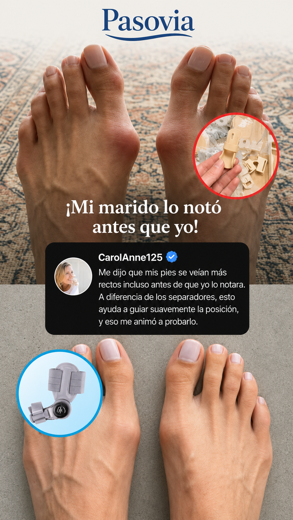 Con la férula puesta